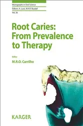 Book cover of Root Caries: From Prevalence to Therapy by M. Rocha de Olivera Carrilho