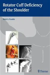 Book cover of Rotator Cuff Deficiency of the Shoulder by Mark Frankle