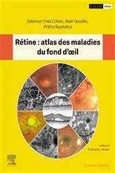 Book cover of Rétine : atlas des maladies du fond d'oeil by Salomon Yves Cohen