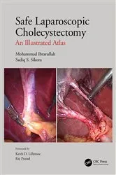 Book cover of Safe Laparoscopic Cholecystectomy by Mohammad Ibrarullah