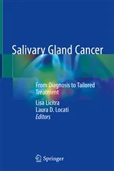 Book cover of Salivary Gland Cancer by Lisa Licitra