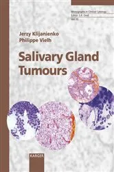Book cover of Salivary Gland Tumours by P. Vielh
