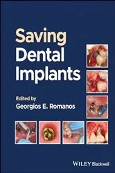 Book cover of Saving Dental Implants by Georgios E. Romanos