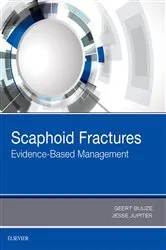 Book cover of Scaphoid Fractures by Buijze MD PhD, Hand Surgeon, Geert Alexander