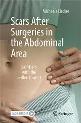 Book cover of Scars After Surgeries in the Abdominal Area by Michaela Liedler