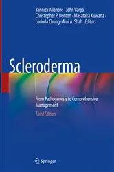 Book cover of Scleroderma (3rd ed.) by Unknown