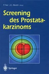 Book cover of Screening des Prostatakarzinoms by Peter Faul