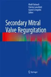 Book cover of Secondary Mitral Valve Regurgitation by Khalil Fattouch