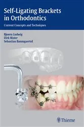 Book cover of Self-Ligating Brackets in Orthodontics by Björn Ludwig