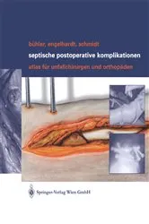 Book cover of Septische postoperative Komplikationen by Matthias Bühler