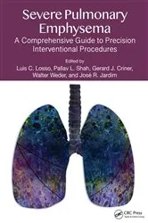 Book cover of Severe Pulmonary Emphysema: by Luis C. Losso