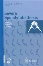 Book cover of Severe Spondylolisthesis by J. Harms