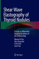 Book cover of Shear Wave Elastography of Thyroid Nodules by Myung Hi Yoo
