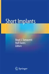 Book cover of Short Implants by Boyd J. Tomasetti