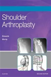 Book cover of Shoulder Arthroplasty E-Book (2nd ed.) by T. Bradley Edwards MD