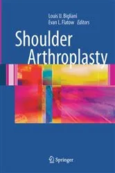 Book cover of Shoulder Arthroplasty by Louis U. Bigliani