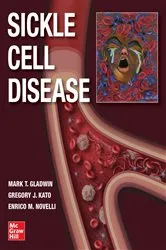 Book cover of Sickle Cell Disease by Mark T. Gladwin