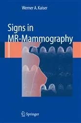 Book cover of Signs in MR-Mammography by Werner A. Kaiser