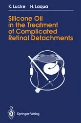 Book cover of Silicone Oil in the Treatment of Complicated Retinal Detachments by Klaus Lucke