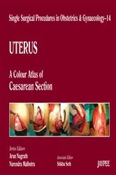 Book cover of Single Surgical Procedures in Obstetrics and Gynaecology–14 by Nagrath Arun