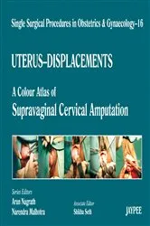 Book cover of Single Surgical Procedures in Obstetrics and Gynaecology–16 by Arun Nagrath