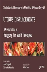 Book cover of Single Surgical Procedures in Obstetrics and Gynaecology–20 by Arun Nagrath