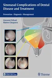 Book cover of Sinonasal Complications of Dental Disease and Treatment by Giovanni Felisati