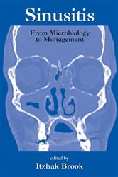 Book cover of Sinusitis by Itzhak Brook