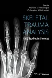 Book cover of Skeletal Trauma Analysis by Nicholas V. Passalacqua