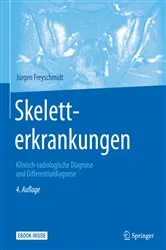 Book cover of Skeletterkrankungen (4th ed.) by Jürgen Freyschmidt