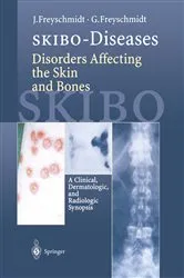 Book cover of SKIBO-Diseases Disorders Affecting the Skin and Bones by Jürgen Freyschmidt