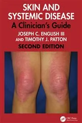 Book cover of Skin and Systemic Disease (2nd ed.) by Joseph C. English III