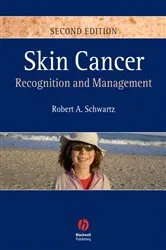 Book cover of Skin Cancer (2nd ed.) by Robert A. Schwartz