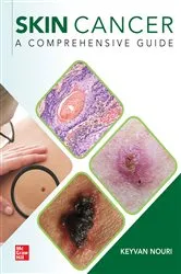 Book cover of Skin Cancer: A Comprehensive Guide by Keyvan Nouri