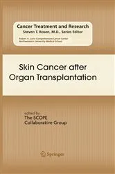 Book cover of Skin Cancer after Organ Transplantation by Eggert Stockfleth