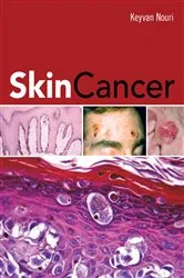 Book cover of Skin Cancer by Keyvan Nouri
