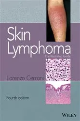 Book cover of Skin Lymphoma (4th ed.) by Unknown