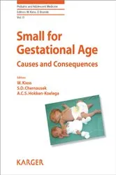 Book cover of Small for Gestational Age by Unknown