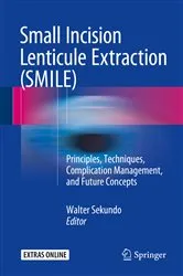 Book cover of Small Incision Lenticule Extraction (SMILE) by Walter Sekundo