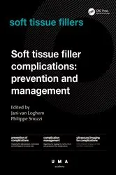 Book cover of Soft Tissue Filler Complications by Jani van Loghem