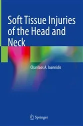 Book cover of Soft Tissue Injuries of the Head and Neck by Charilaos A. Ioannidis