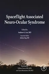 Book cover of Spaceflight Associated Neuro-Ocular Syndrome by Andrew G. Lee MD