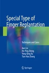 Book cover of Special Type of Finger Replantation by Jian Lin