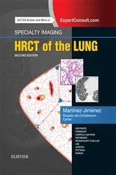 Book cover of Specialty Imaging: HRCT of the Lung E-Book (2nd ed.) by Santiago Martínez-Jiménez MD
