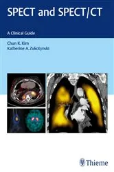 Book cover of SPECT and SPECT/CT by Chun Kim