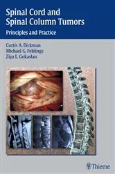 Book cover of Spinal Cord and Spinal Column Tumors by Curtis A. Dickman