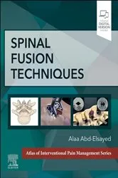 Book cover of Spinal Fusion Techniques - E-Book by Unknown
