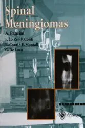 Book cover of Spinal Meningiomas by A. Pansini
