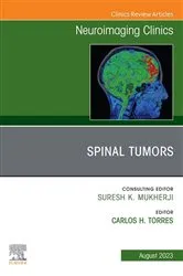 Book cover of Spinal Tumors, An Issue of Neuroimaging Clinics of North America, E-Book by Torres MD, FRCPC, Carlos H.