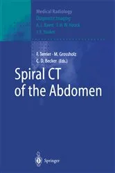 Book cover of Spiral CT of the Abdomen by F. Terrier